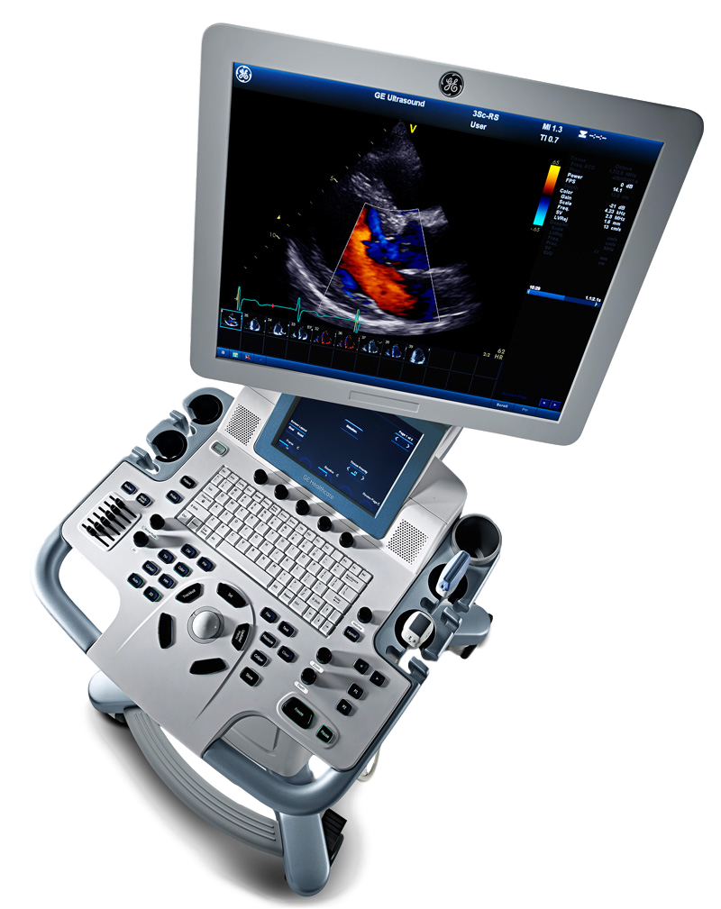 УЗИ аппарат GE Vivid T8_69dabdbd049fc.png УЗИ аппарат GE Vivid T8 — изображение 1