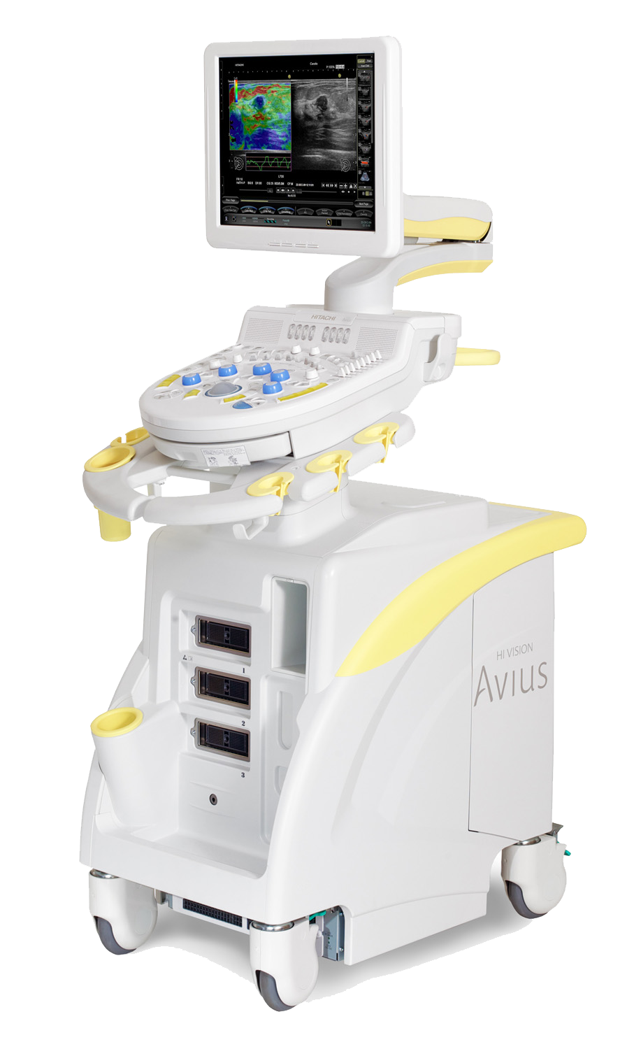 УЗИ аппарат Hitachi Hi Vision Avius_69dabd0d4691f.png УЗИ аппарат Hitachi Hi Vision Avius — изображение 1