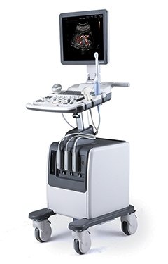 УЗИ аппарат Medison SonoAce R7_69dabc4f9389e.jpeg УЗИ аппарат Medison SonoAce R7 — изображение 1