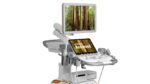 УЗИ аппарат Siemens Acuson Redwood — изображение 3