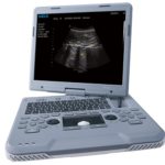 УЗИ аппарат Siui Apogee 1100 Neo