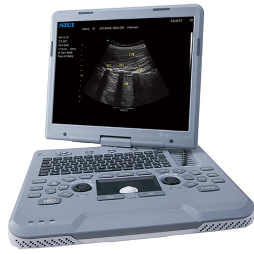 УЗИ аппарат Siui Apogee 1100 Neo_69d3af3868cf7.jpeg УЗИ аппарат Siui Apogee 1100 Neo — изображение 1