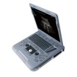 УЗИ аппарат Siui Apogee 1100 Neo — изображение 2