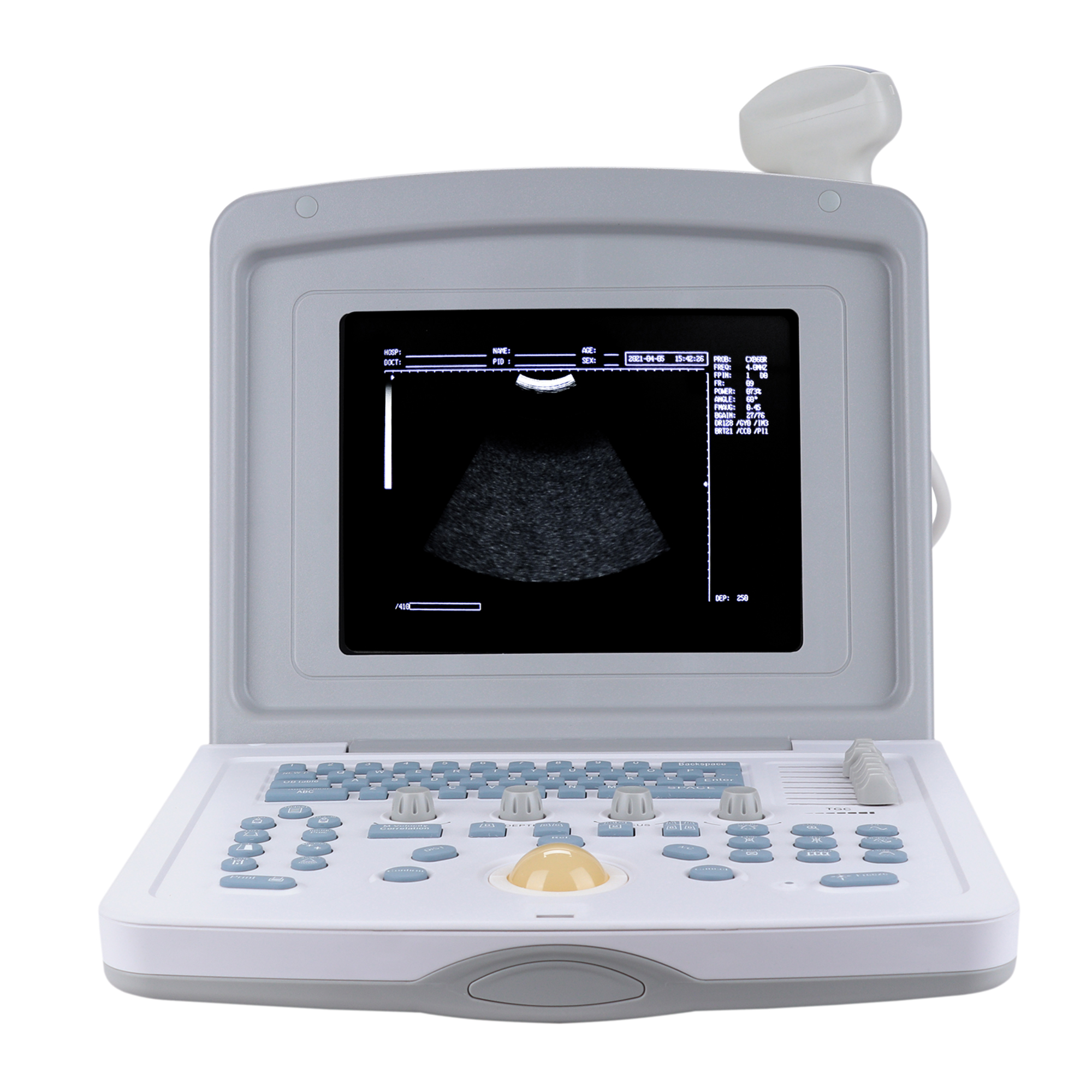 УЗИ сканер Med-Mos CMS600B3_69d3ae1ec6ff0.jpeg УЗИ сканер Med-Mos CMS600B3 — изображение 5