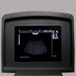 УЗИ сканер Med-Mos CMS600B3 — изображение 13