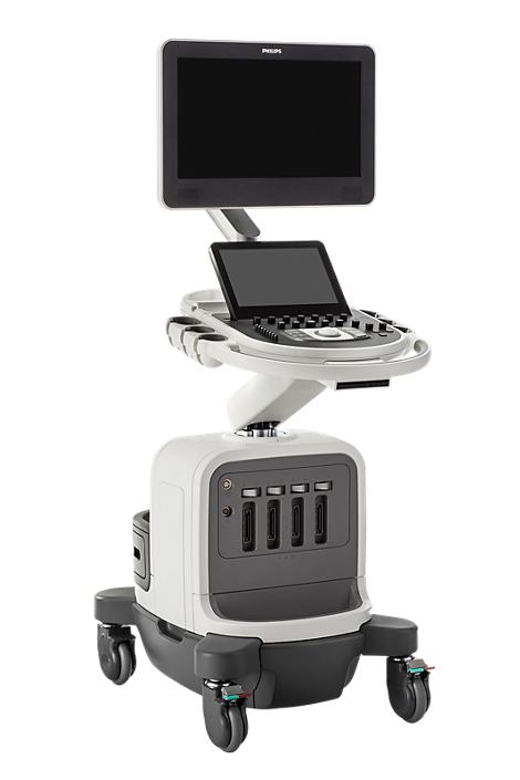 УЗИ-сканер Philips Affiniti 70_69db49607bab9.png УЗИ-сканер Philips Affiniti 70 — изображение 1